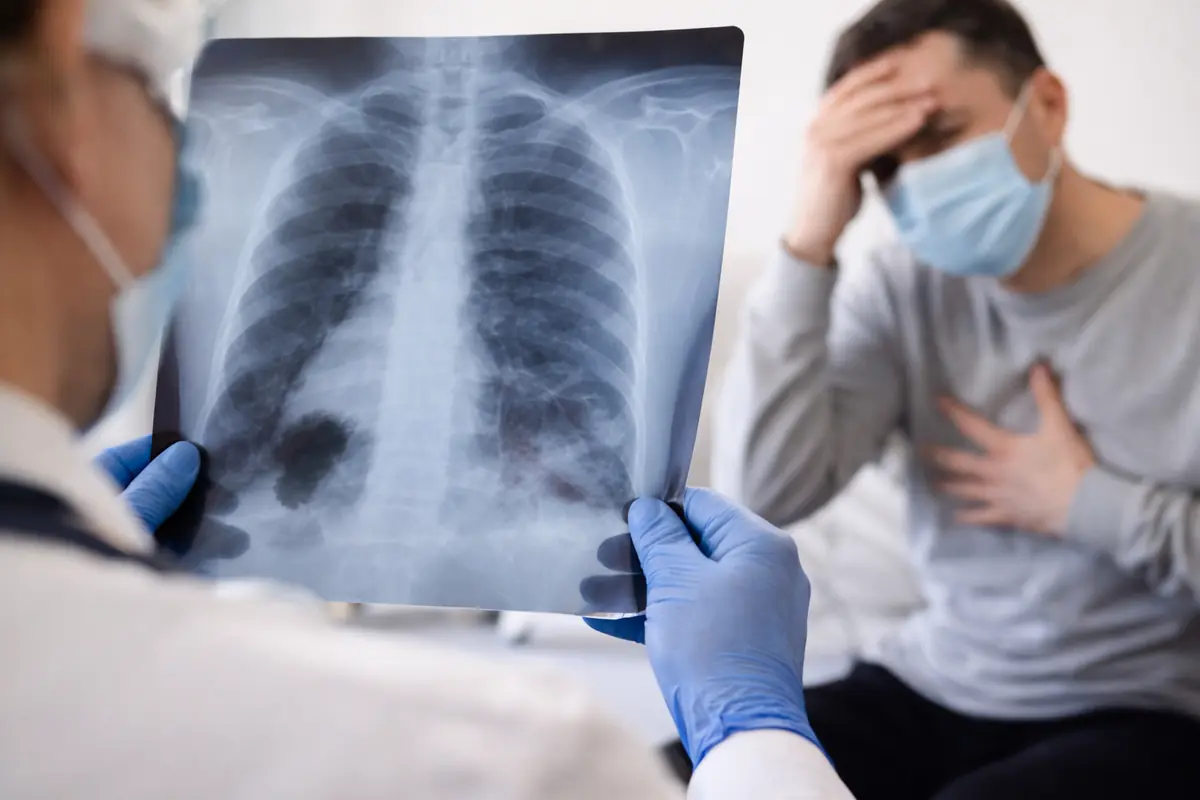 Chi ha avuto il Covid rischia il cancro: l'allarme dei medici spaventa gli italiani